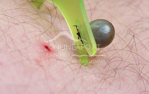 mosquito® Zecken-Karte mit integrierter Lupe