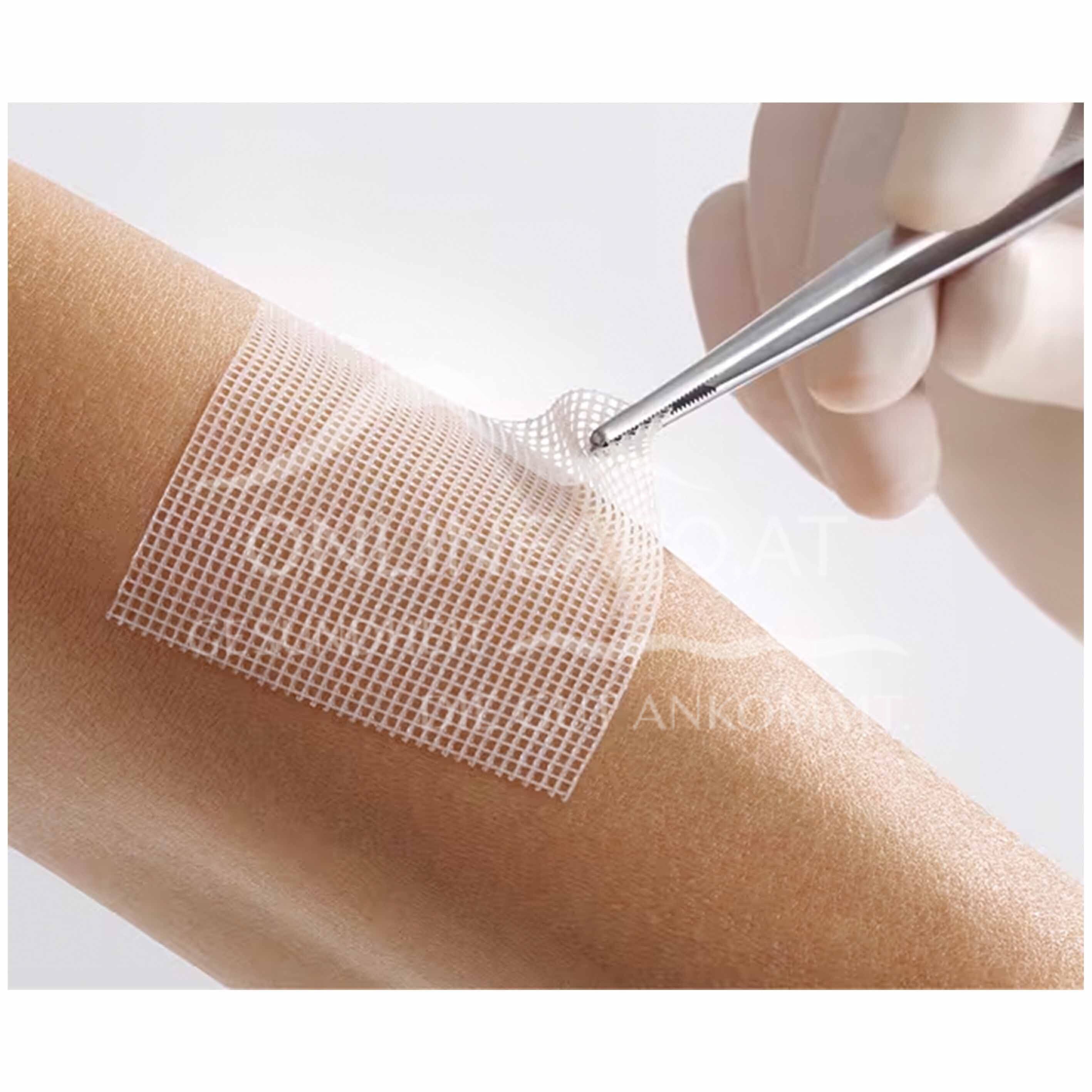 Lomatuell® Pro Gelbildendes Kontaktnetz steril, 10 x 20 cm
